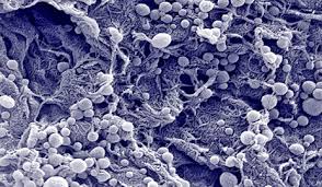 Vật liệu nano có thể làm tăng khả năng chống ung thư của các tế bào miễn dịch